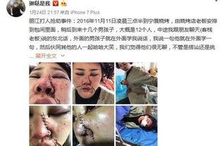 爆料博主毁容视频大全,毁容视频大全深度解析